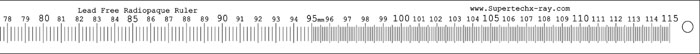 Supertech 115cm Extremity Acrylic Radiopaque Ruler Part 3
